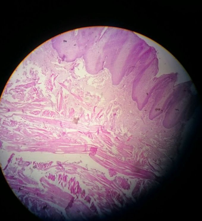 What is this?