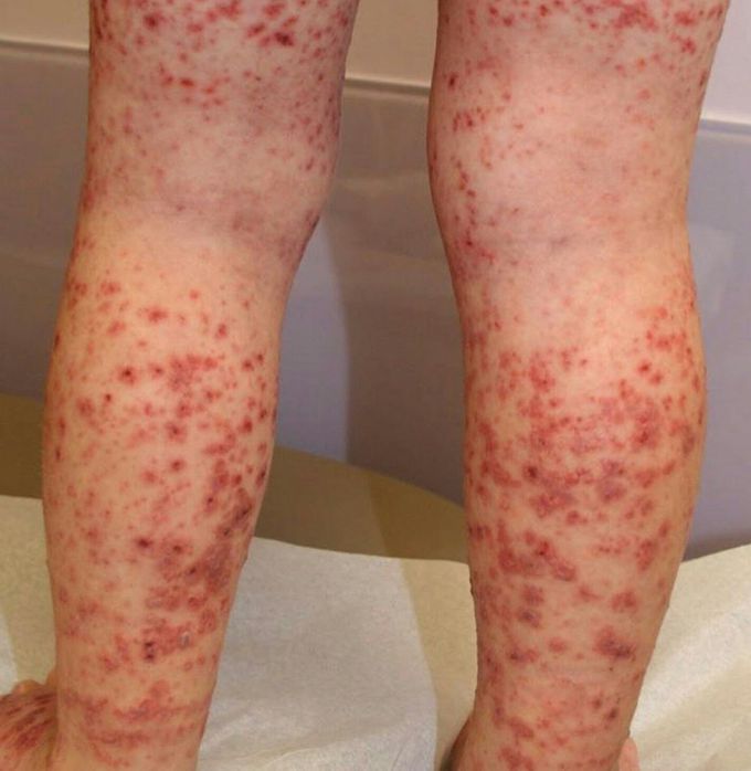 Diagnosis????