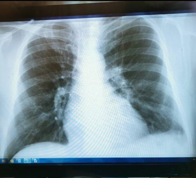 Whats your diagnose ??