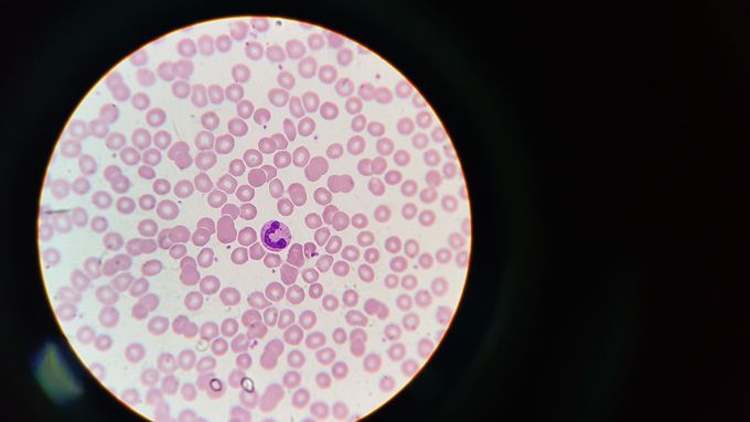 Guess What Component of Leucocyte This Is??
