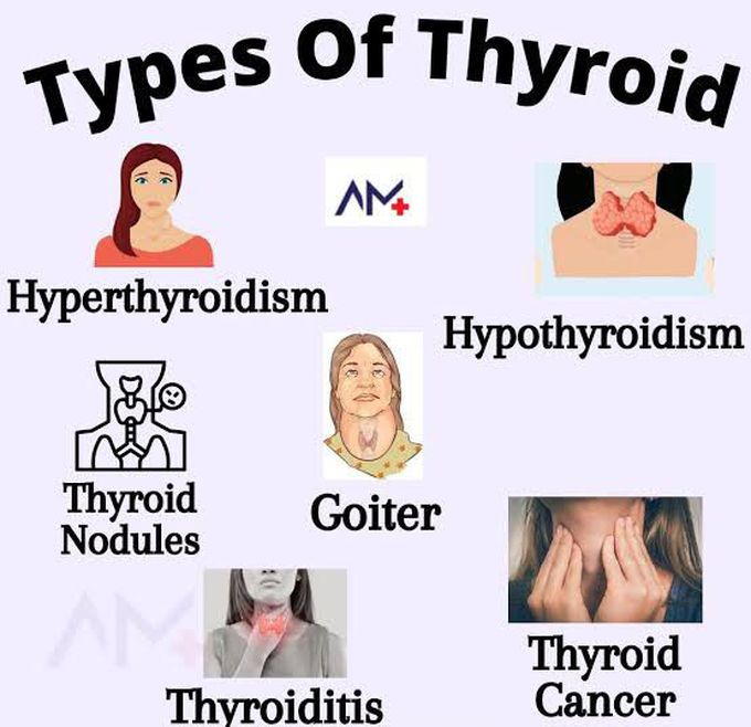 These are the types of Thyroid