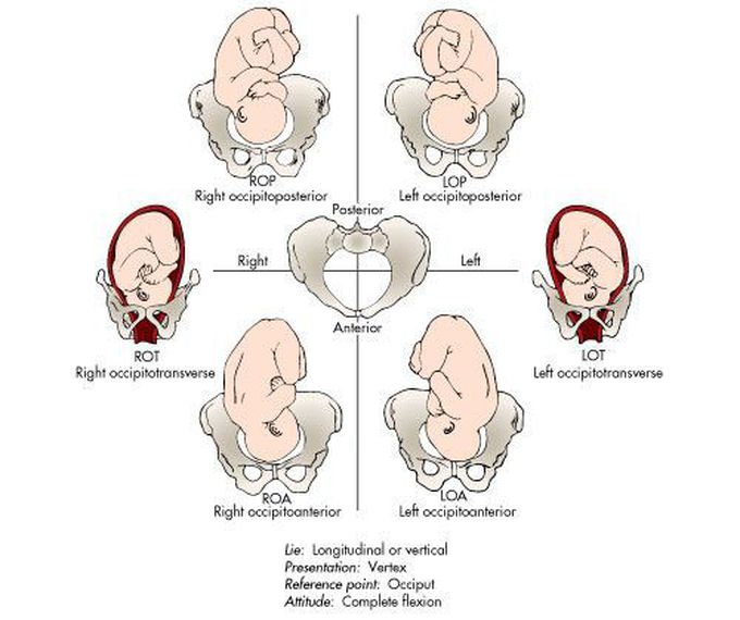abnormal position and presentation of the fetus