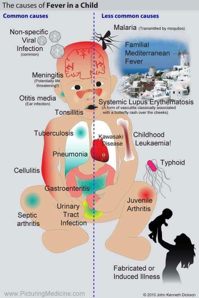 Causes of fever in children