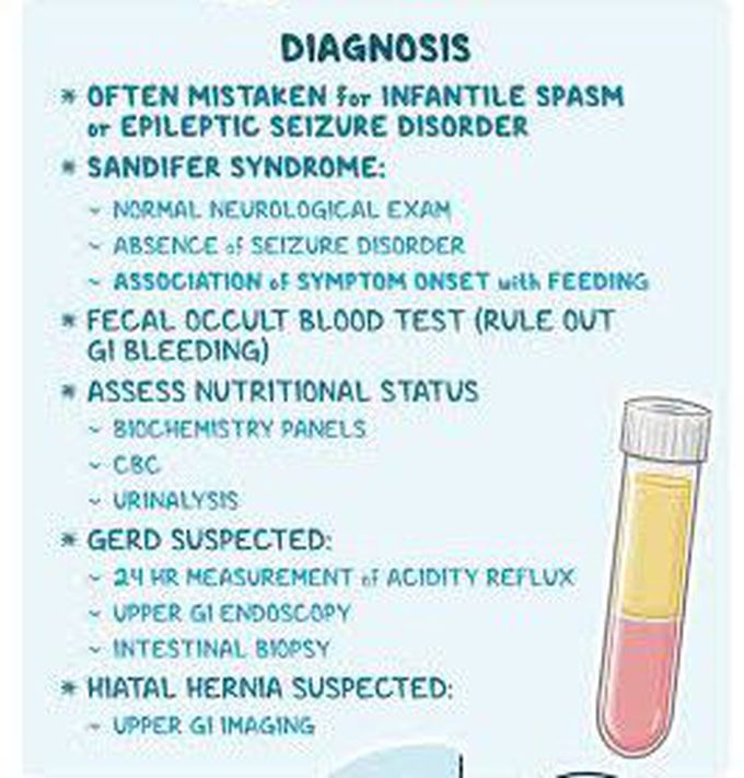 This is the diagnosis of Sandifer syndrome