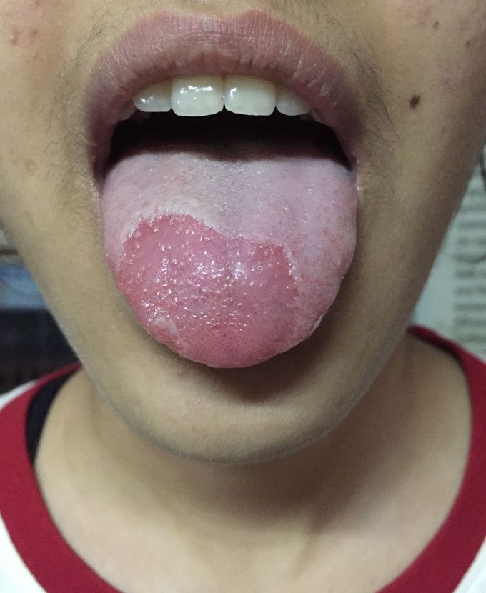 Diagnosis???
