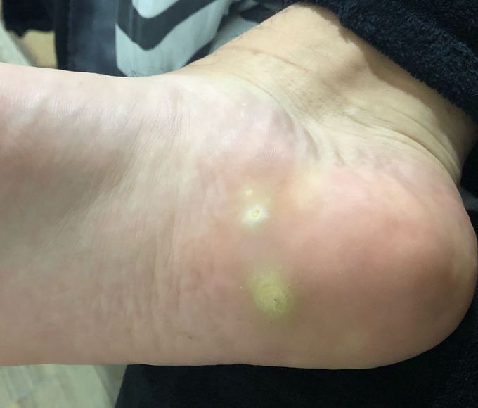 Diagnosis??