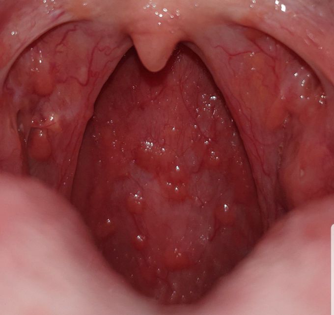 Diagnosis?