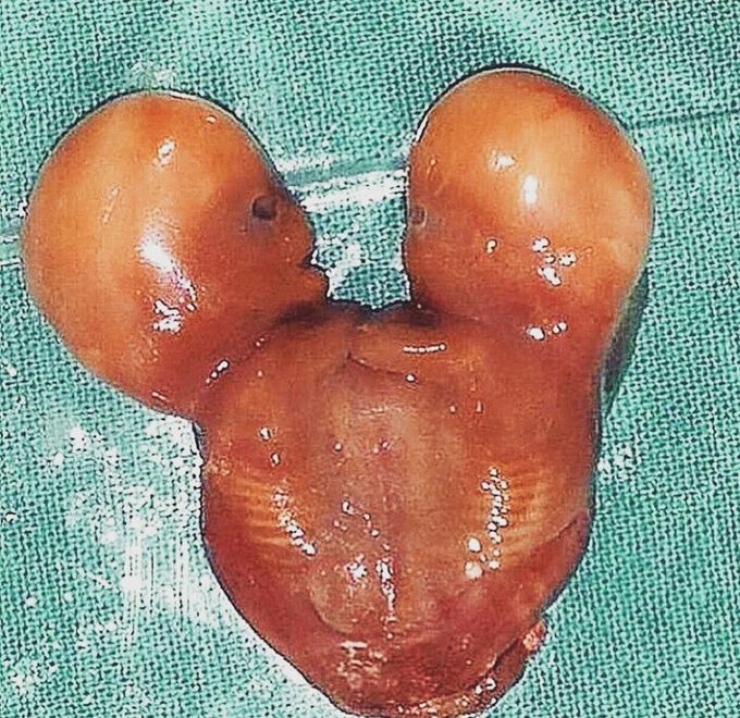 Can you guess the diagnosis?