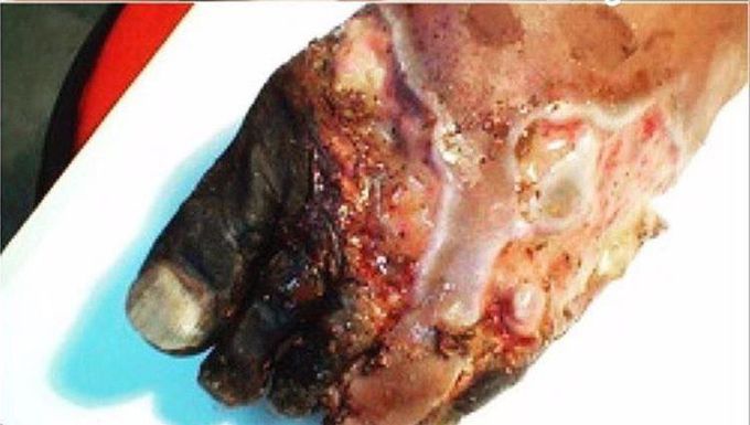 What is your diagnosis