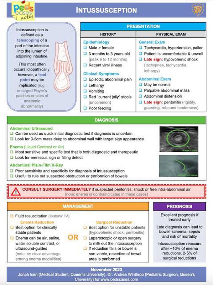 Intussusception