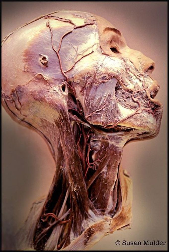 Plastination