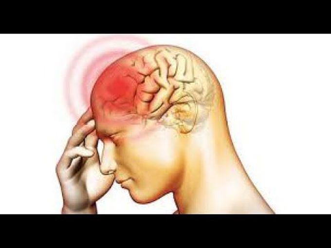 Meningitis Cause, clinical features, diagnosis, treatment, complication.