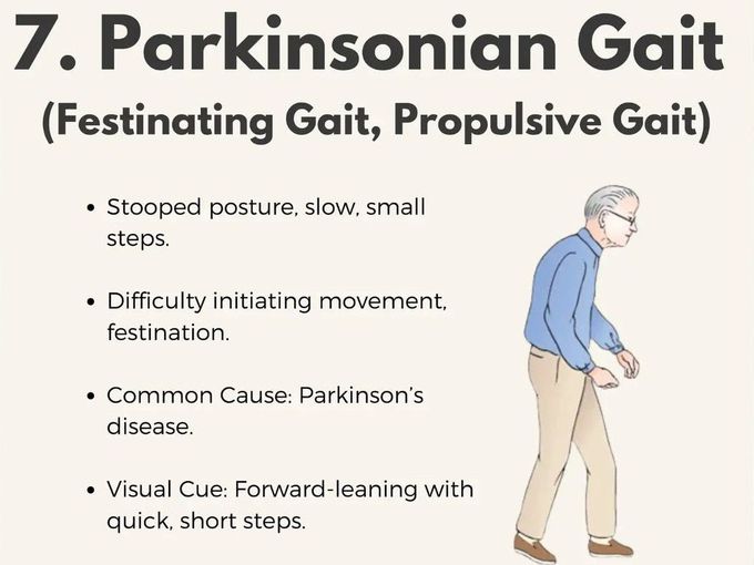 Parkinsonian Gait