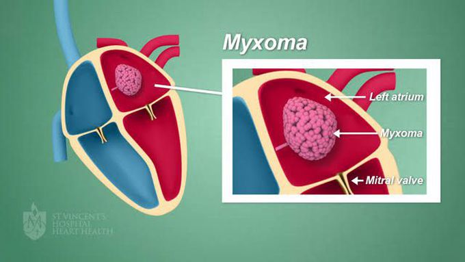 Symptoms of myxoma