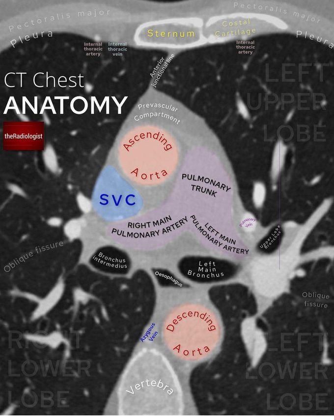 CT Chest Anatomy