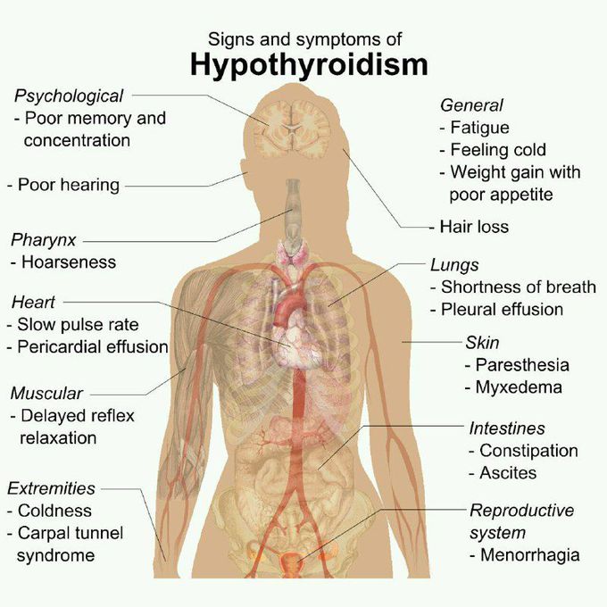 Hypothyroidism