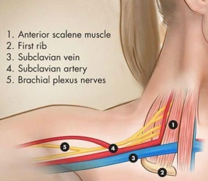 Thoracic Outlet