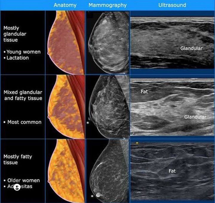 Female Breast Anatomy - MEDizzy