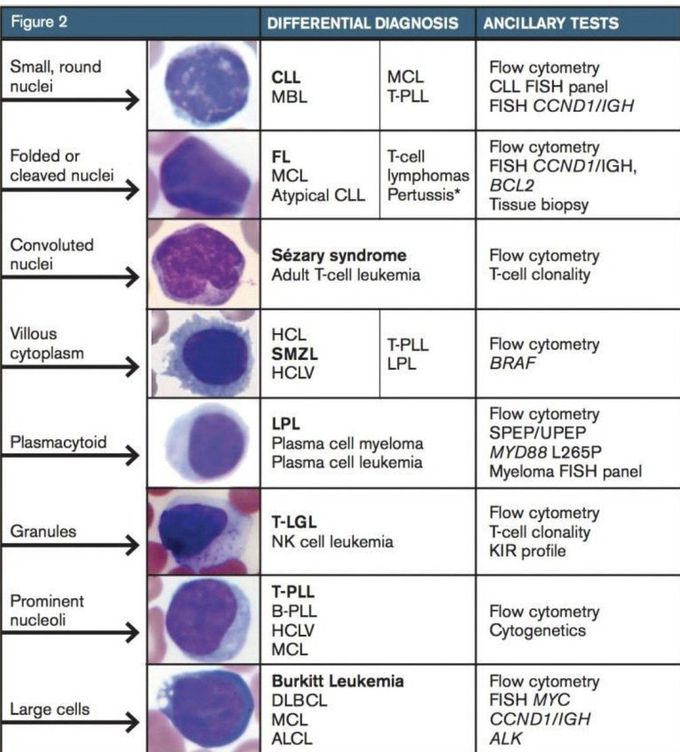 Lymphocytosis