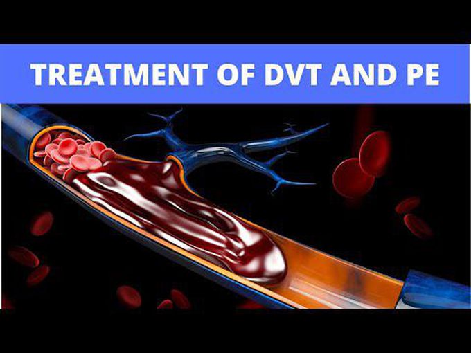 Deep vein thrombosis and Pulmonary
embolism - Treatment options