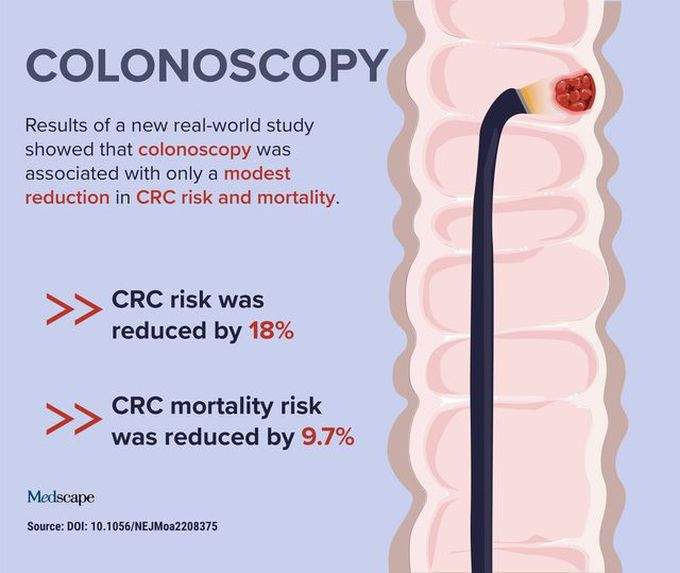 Colonoscopy⁠
