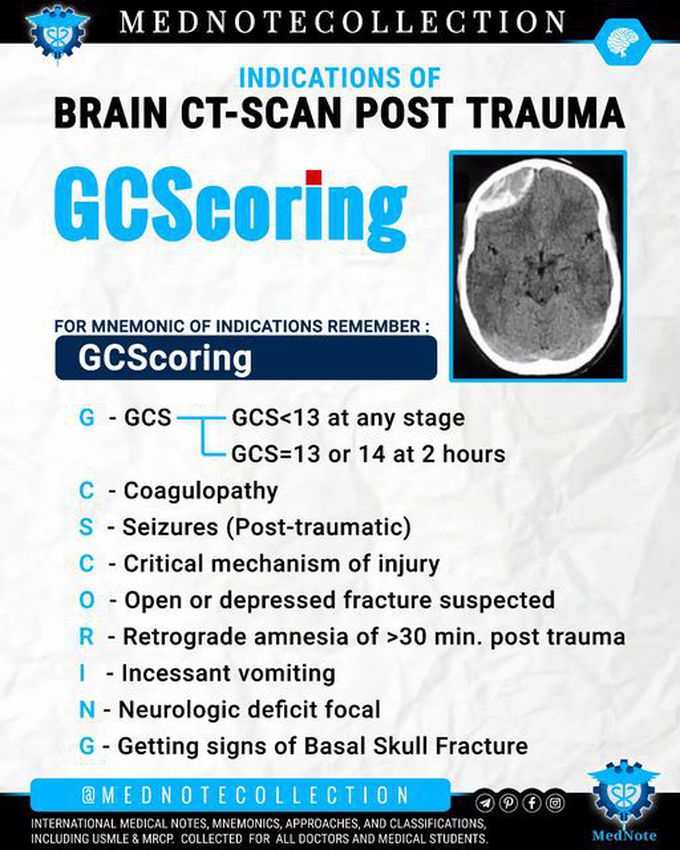 Indications of Brain CT-scan post Trauma