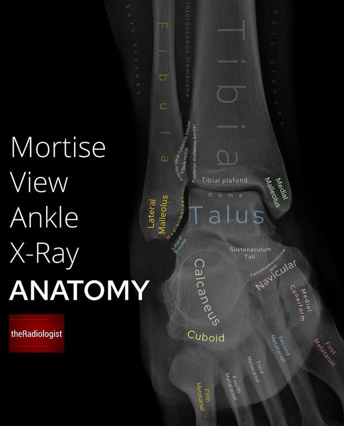 Ankle X-ray Anatomy