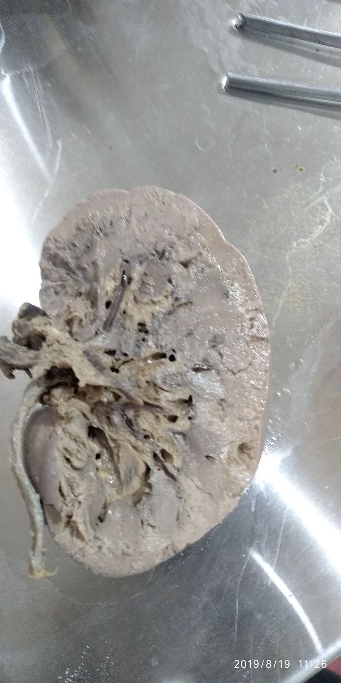 Cut section of  kidney