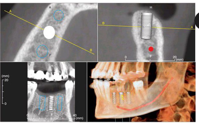 Cone-beam computed tomography image