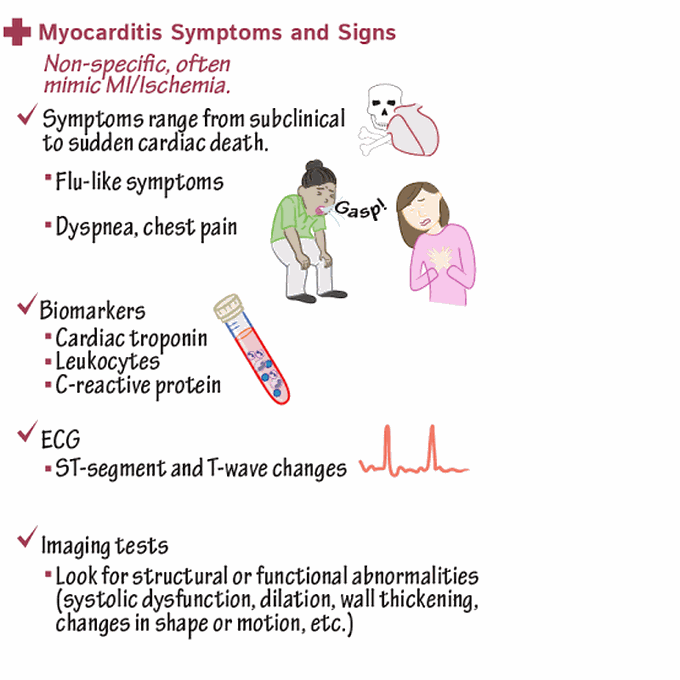 These are the symptoms of myocarditis