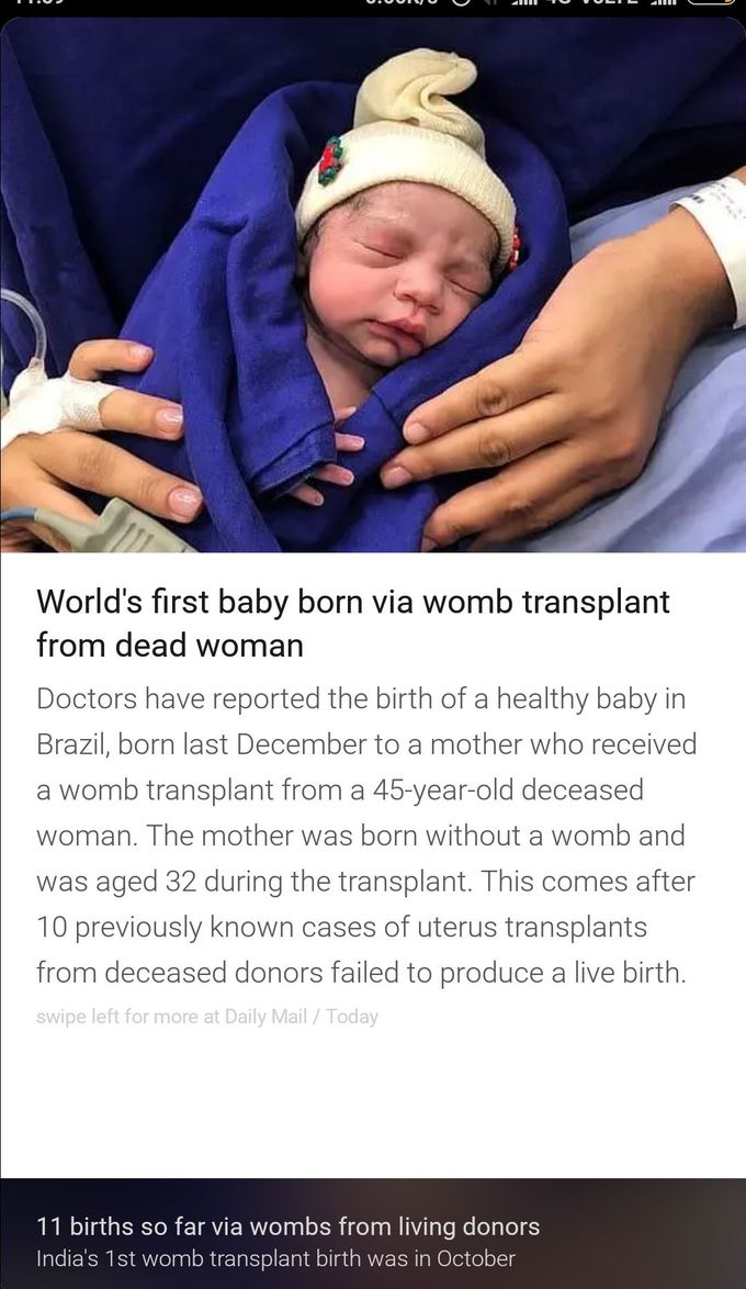 Womb transplant...