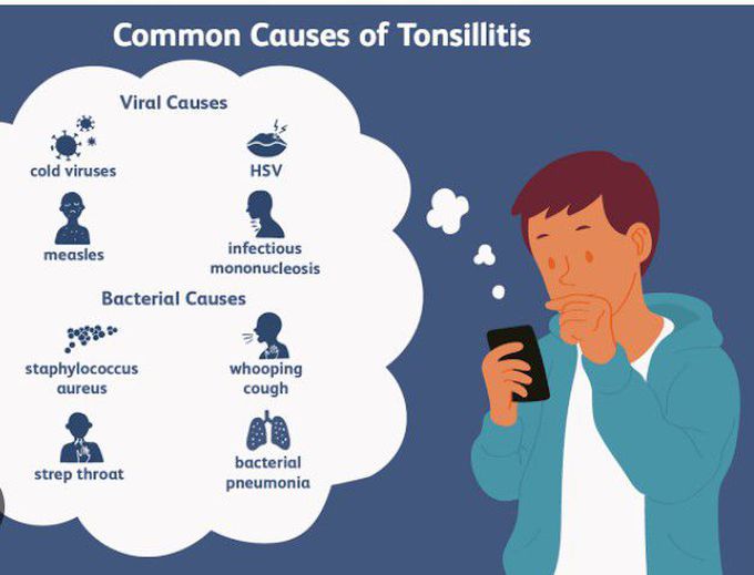 Cause of Tonsillitis