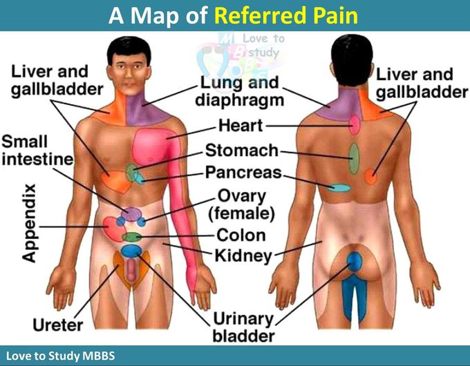 A Map Of Referred Pain