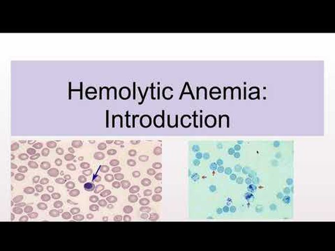 Introduction and classification of Hemolytic Anemia