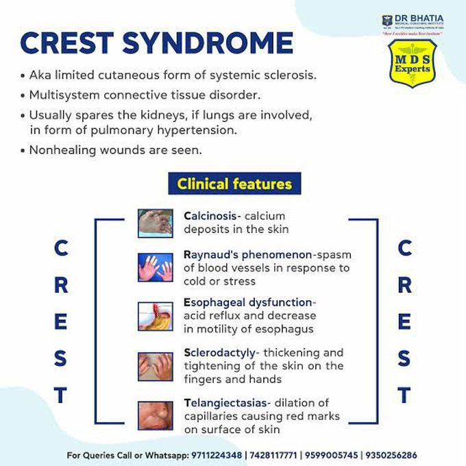 CREST Syndrome