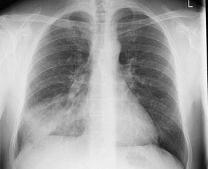 Interepret how u diagnose this X-ray - MEDizzy