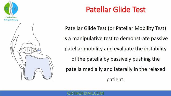 Patellar Glide Test • Easy Explained - OrthoFixar 2022