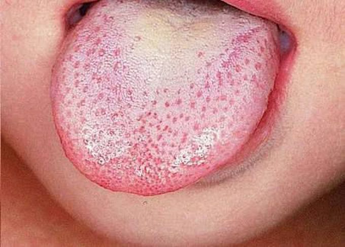 What is the diagnosis?