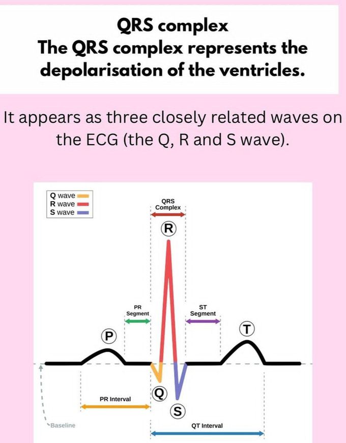 QRS Complex