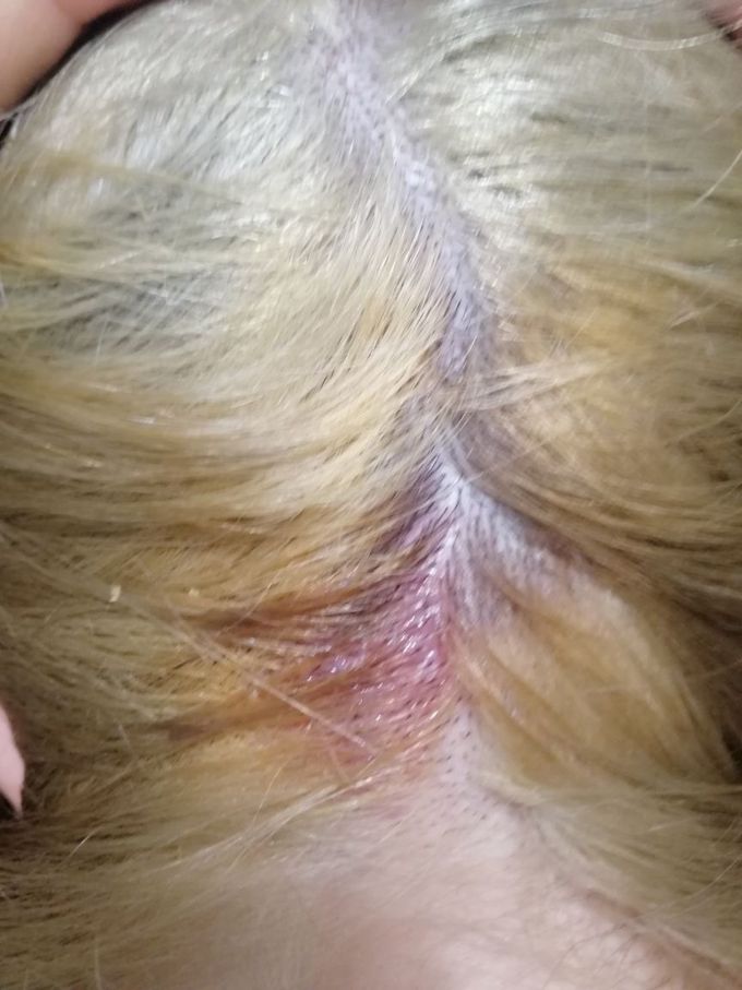 Whats it ? nape