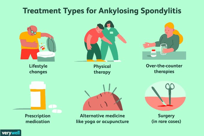 Treatment of spondylitis