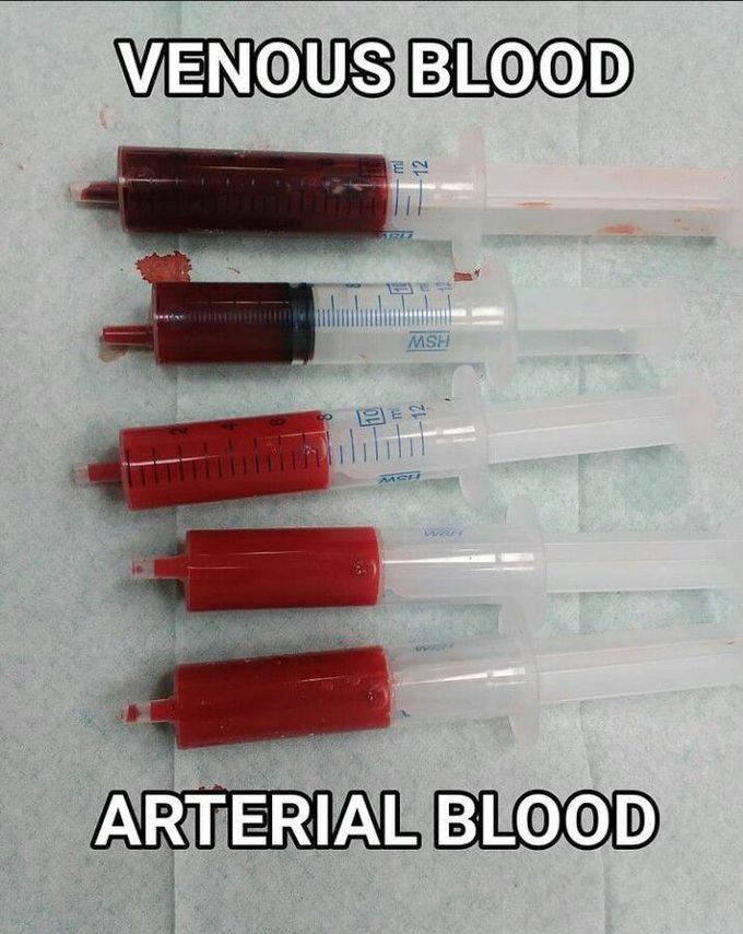 Venous Vs Arterial Blood Medizzy