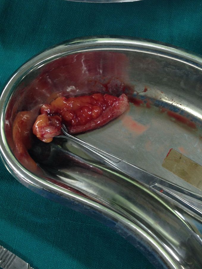 Surgery quiz