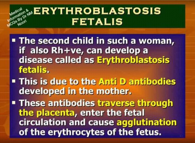 Erthroblastosis fetalis