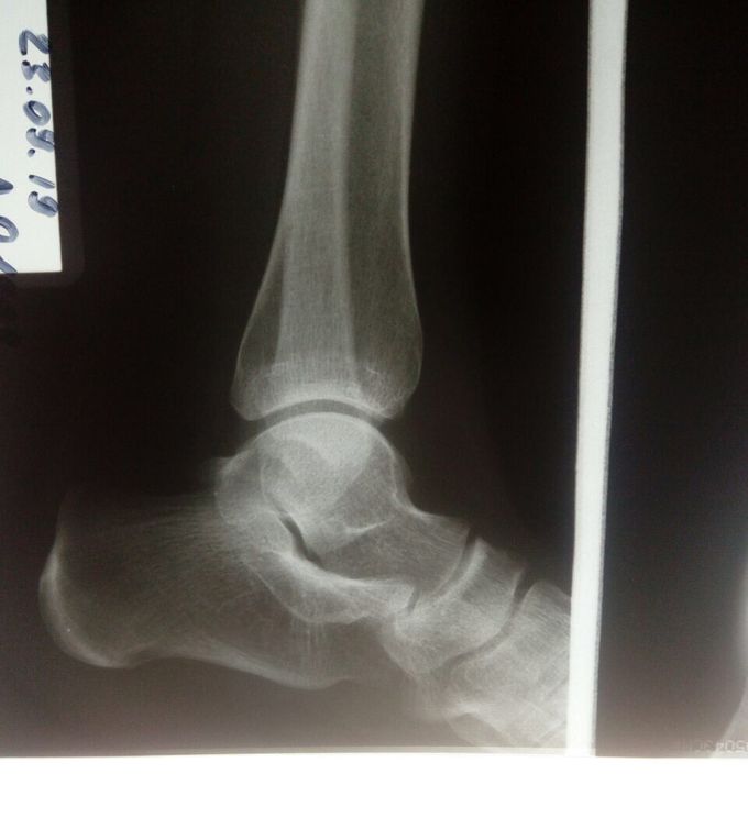 I need your assistance with the description of this x-ray