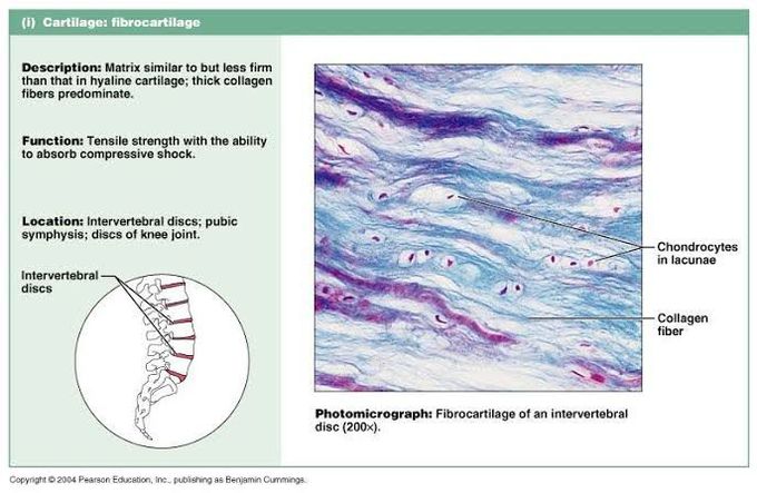 cartilage fibrocartilage