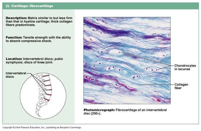 Fibrocartilage