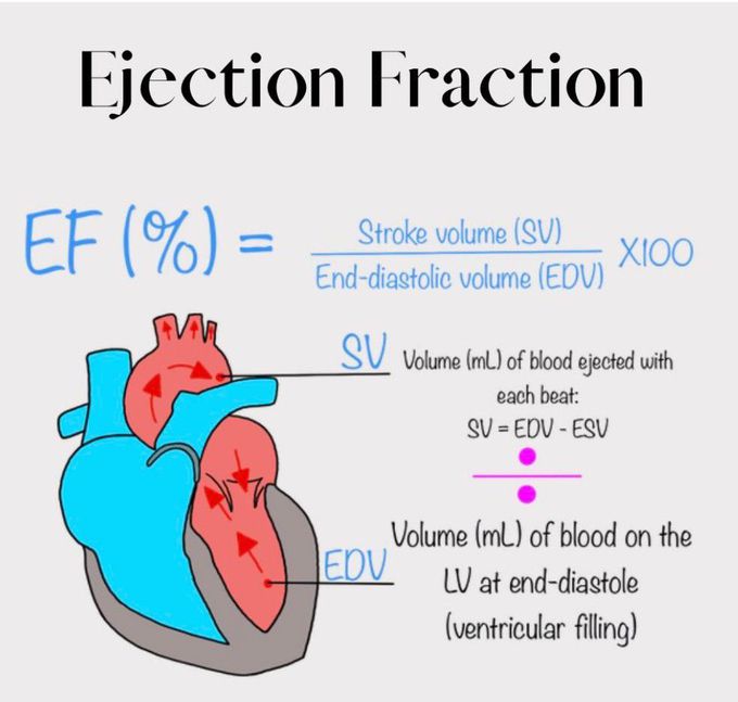 Ejection Fraction