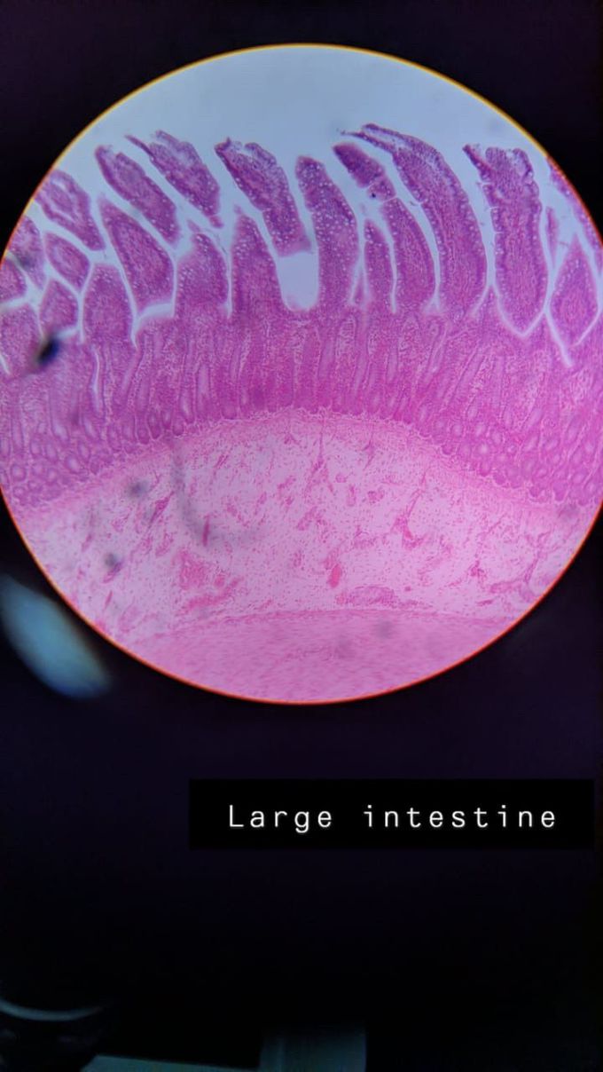 large intestine histology slides