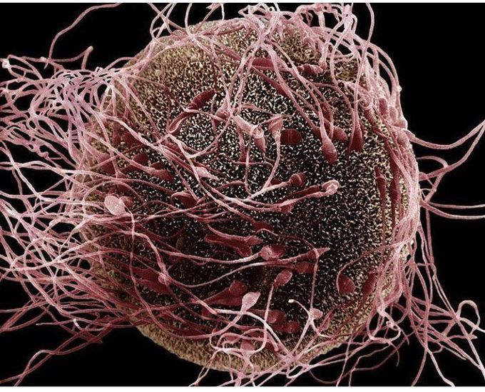 Fertilization...